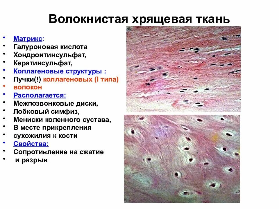 Волокнистая хрящевая соединительная ткань. Волокнистый хрящ ткани гистология. Волокнистая хрящевая ткань межпозвоночного диска теленка. Надхрящница волокнистого хряща.