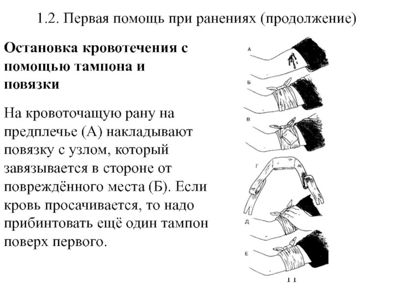 Оказание первой медицинской помощи при ранениях. Правила оказания первой помощи пострадавшему при ранениях. Последовательность оказания первой неотложной помощи при ранениях. Последовательность оказания первой помощи при обработке раны. 1 медицинская помощь при ранении