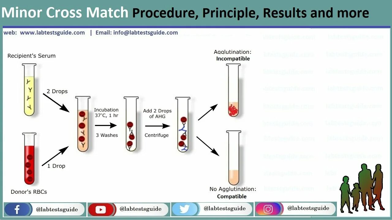 Matching process. Cross Match тест. Cross-Match тест при трансплантации. Cross Match реакция. Кросс матч тест крови.