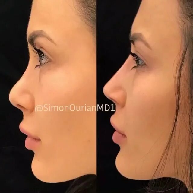 Nice nose