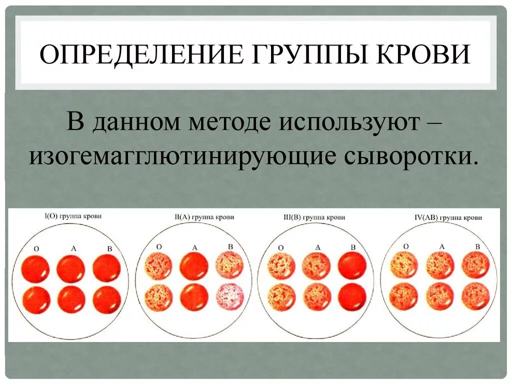 Определите группу крови тест. Определить группу крови и резус-фактора цоликлонами. Группа крови Цоликлоны резус фактор. Цоликлоны для определения группы крови и резус фактора. Метод определения группы крови с помощью цоликлонов.