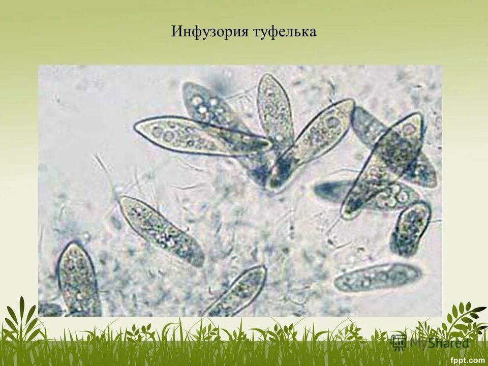 Жизненный цикл инфузории туфельки схема. Строение реснички инфузории. Передвижение инфузории туфельки. Инфузория туфелька вакуоль. Движение инфузории.