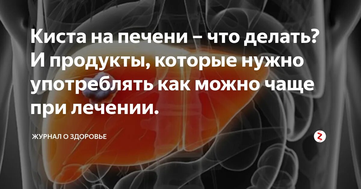 Как лечить кисту печени. Лекарство при кистах= печени. печень киста лекарства. диета при кисте печени.