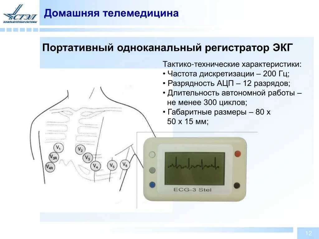 Домашнее экг. Домашние регистраторы экг показатель экг. портативный экг регистратор. дистанционный аппарат передачи экг. одноканальный экг.