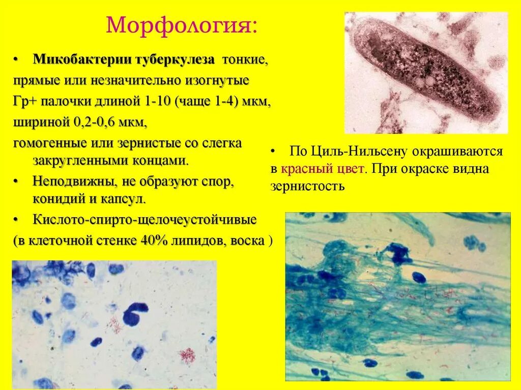 Род туберкулеза. Морфология микобактерий туберкулеза. Палочки – микобактерия туберкулеза. Морфология микобактерий характеризуется. Туберкулеза бациллы Коха.