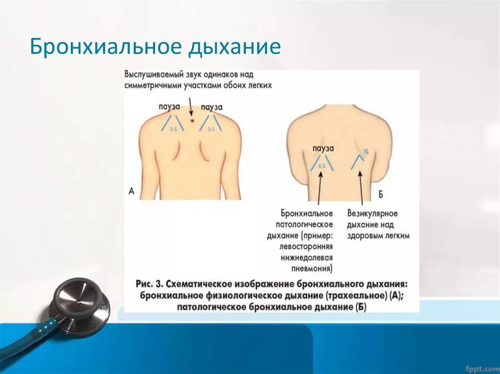 Аускультация везикулярного дыхания. Аускультация везикулярное дыхание. Везикулярное и бронхиальное дыхание в норме. Физиологическое бронхиальное дыхание выслушивается. Места выслушивания везикулярного дыхания в норме.