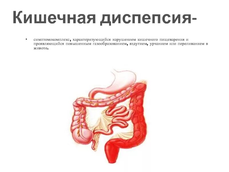 Синдром кишечной диспепсии. Синдром кишечной диспепсии