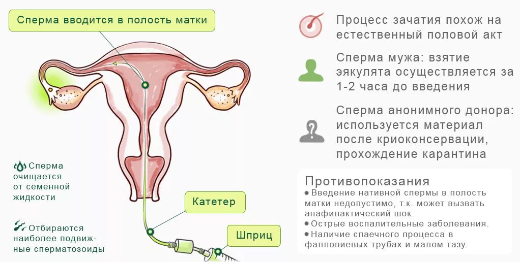 Сколько лежать после зачатия. Процесс зачатия. Половой акт и оплодотворение. Инсеминация. Искусственная инсеминация.