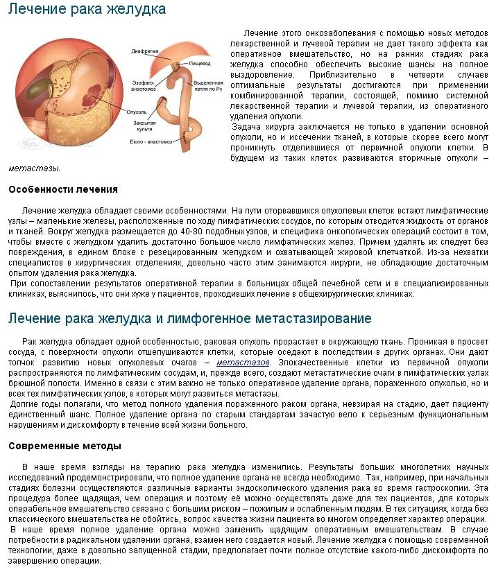 Сколько лечится рак. Диета при онкологии ЖКТ. Диета при онкологии желудка. Диета при больном желудке. Диета при удаленном желудке.