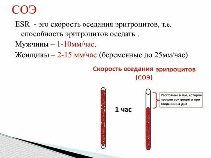 Соэ после кесарево