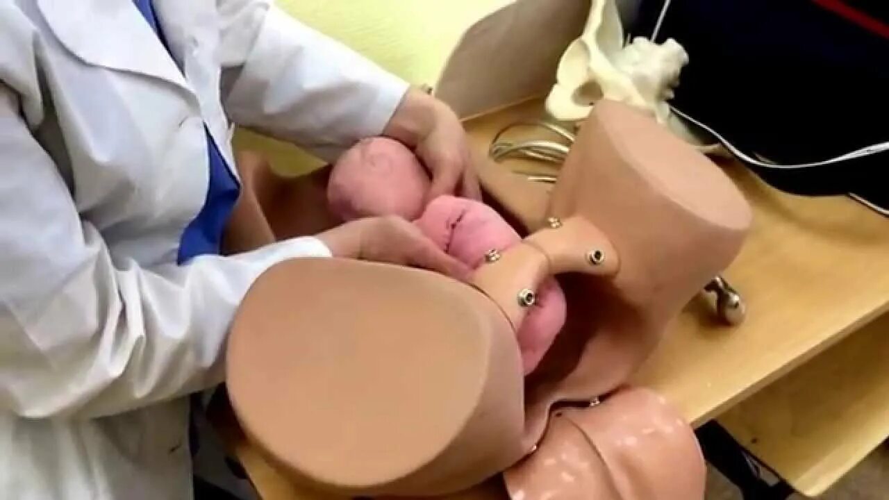 Тазовые роды видео