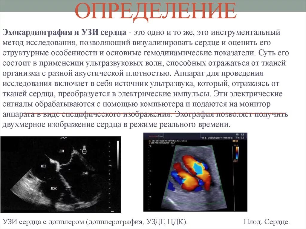 Как проходят эхо. Эхокардиография методы исследования. Ультразвуковое исследование сердца методы эхокардиографии. ЭХОКГ методика проведения. Принцип метода эхокардиографии.