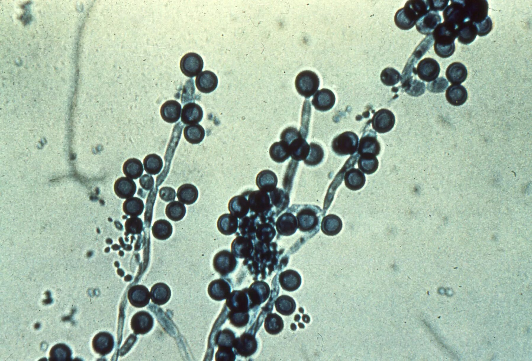 Грибы candida albicans