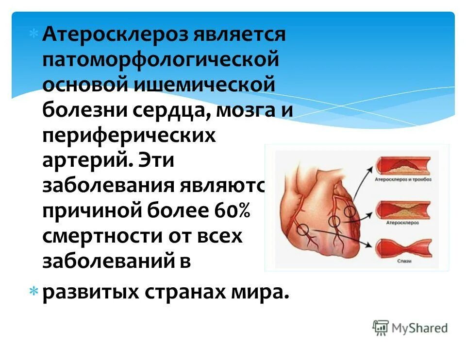 Атеросклеротическая болезнь сердца. Атеросклерозная болезнь сердца. атеросклероз ишемическая болезнь сердца.