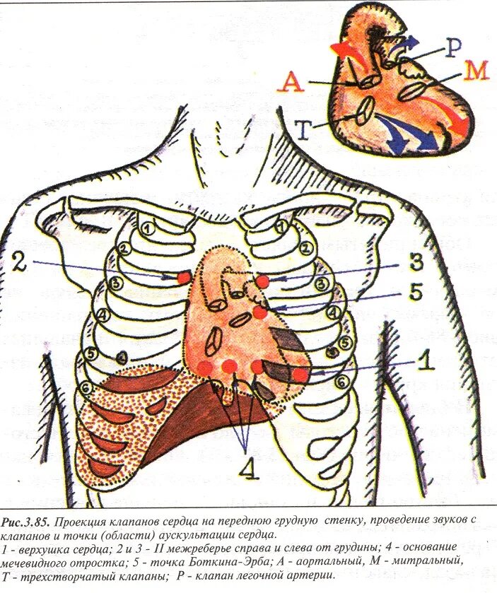 Аускультация сердца проекция клапанов. Аускультация сердца Боткина Эрба. 5 Точек аускультации сердца. Точка Эрба при аускультации сердца. Клапаны сердца на грудной клетке