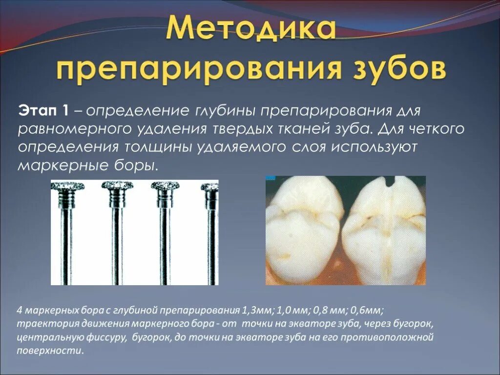 Принципы препарирования твердых тканей зуба. Препарирование твердых тканей зуба. этапы препарирования зуба.