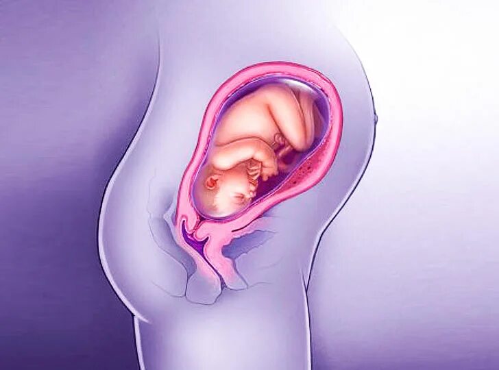 30 неделя б. Ребёнок 30 неделя беременности в утробе. Расположение ребенка в животе. Плод на 30 неделе беременности. Расположение ребенка на 31 неделе беременности.