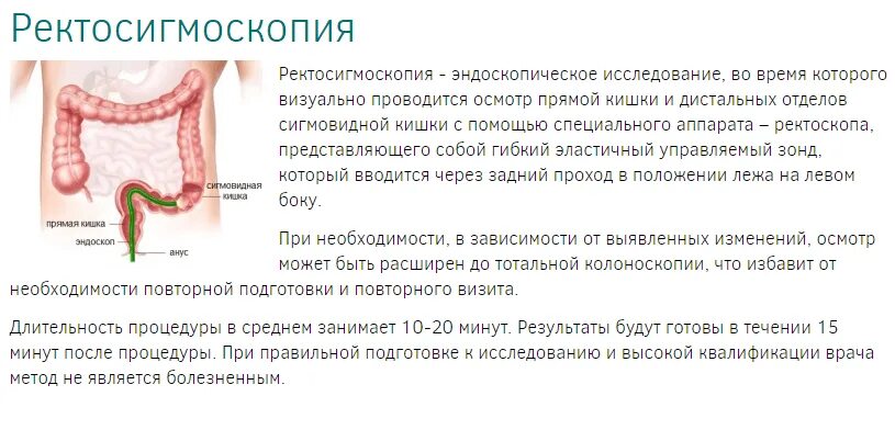 Название эндоскопическое исследование Толстого кишечника. Эндоскопическое исследование нижних отделов кишечника. Дистальный отдел Толстого кишечника. Эндоскопическое исследование сигмовидной кишки. Операции через прямую кишку