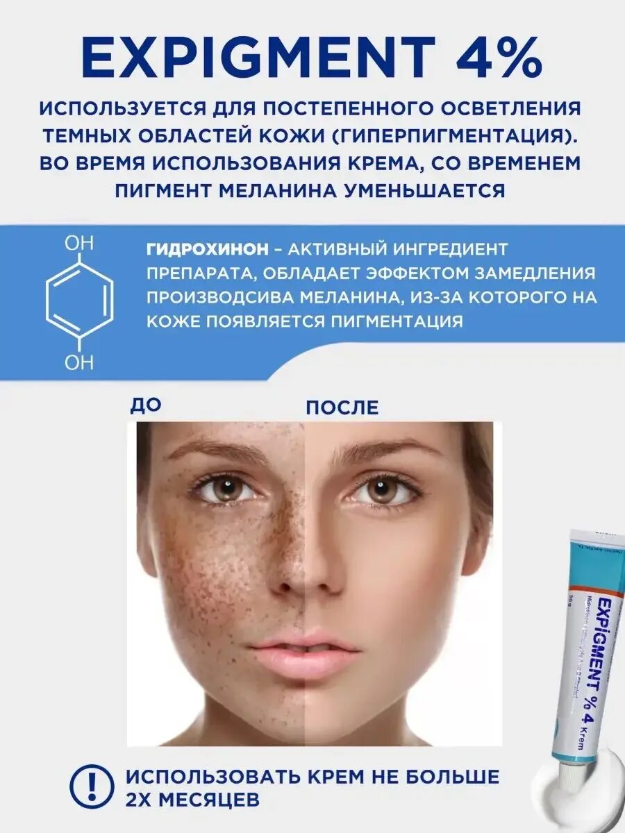 Крем expigment 4 отзывы. Expigment 4. Отбеливающий крем expigment 4. Турецкий отбеливающий крем expigment. Гидрохинон expigment.