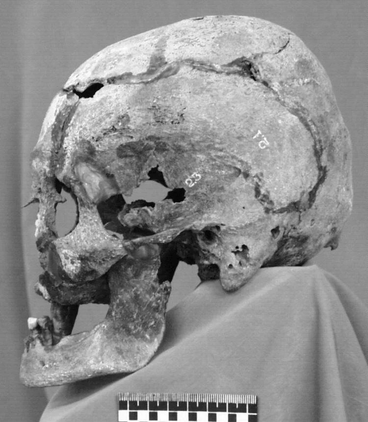 Царская семья романовых расстрел останки. Идентификация останков. Царская семья николая 2 останки. Реконструкция черепа останков романовых. Экспедиция франклина захоронение.