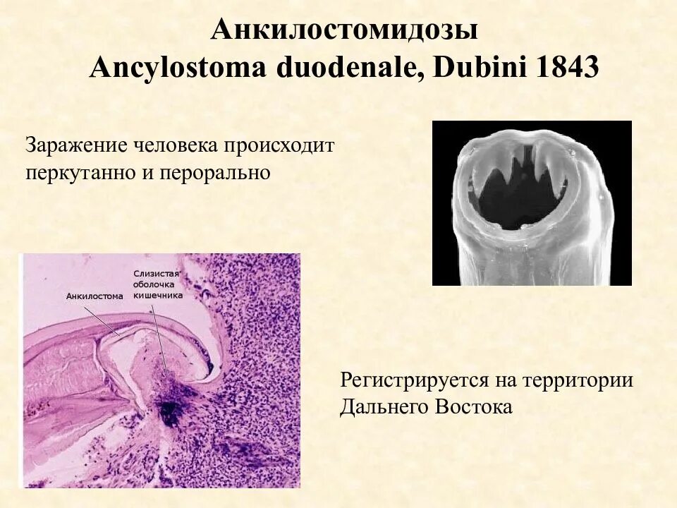 Перкутанный путь заражения. Анкилостома геогельминты. Анкилостомидоз клинические проявления. Анкилостома (Ancylostoma duodenale).