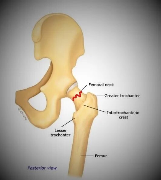 Симптомы шейка бедра у женщины. Шейка бедра анатомия человека. Скелет человека шейка бедра. Строение шейки бедра человека.