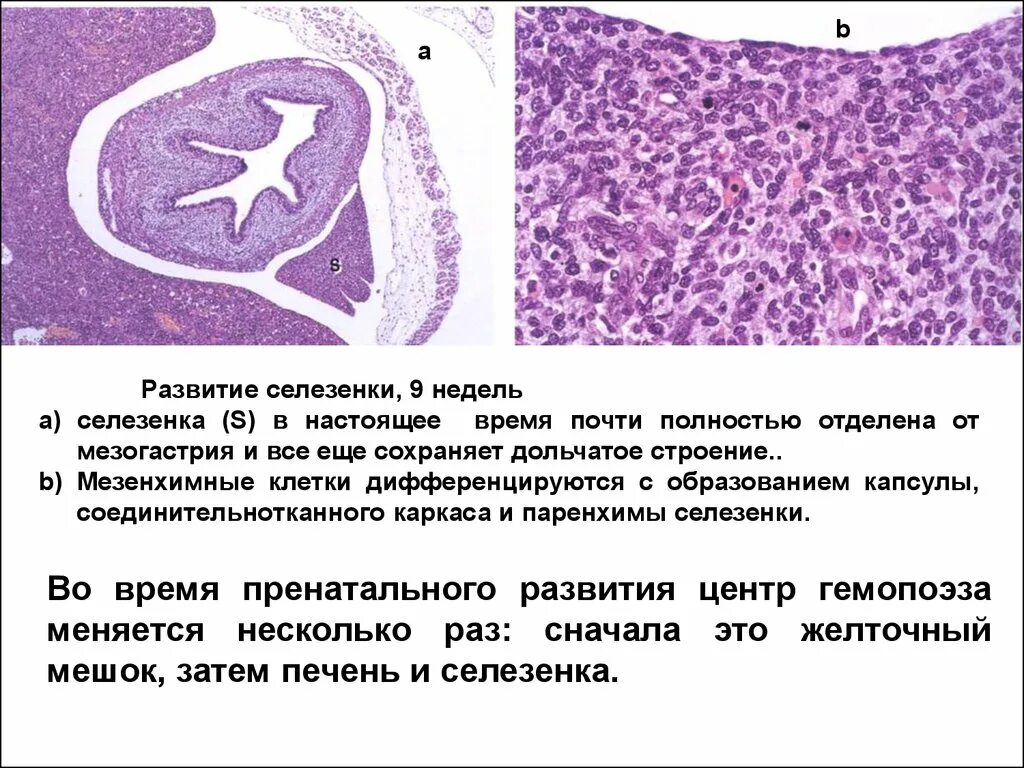 Процесс селезенки. Красная пульпа селезенки гистология. Зоны селезенки гистология. Строма селезенки гистология. Эмбриональные источники развития селезенки.