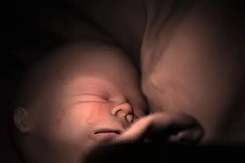 Двойня 25 недель. Двойняшки в утробе матери. Двойняшки внутриутробно. Плод близнецов в утробе матери.