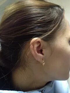 Микронаушник в ухе
