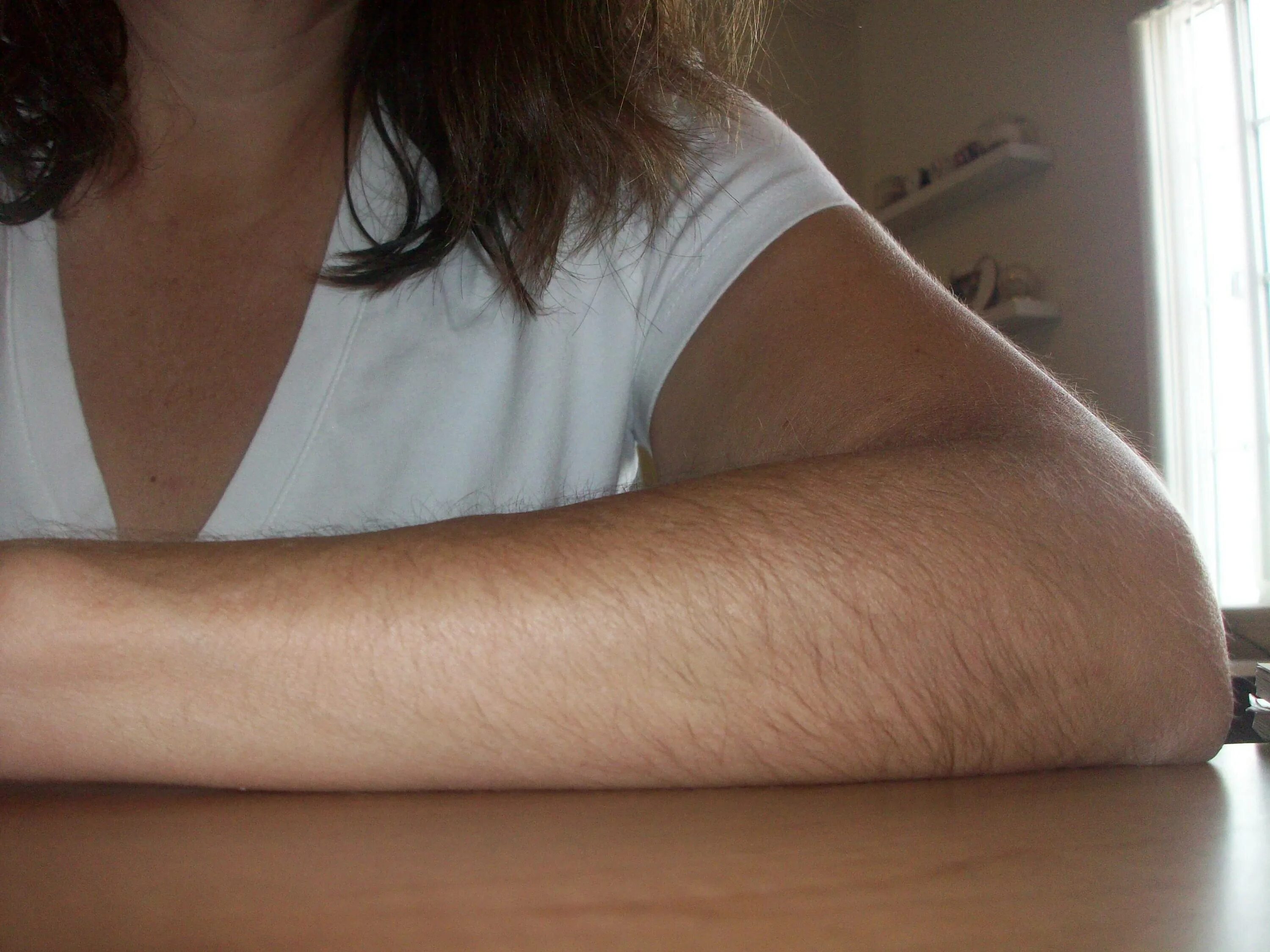 волосы на руках у женщин. волосы на руках у женщин. волосы на руках у девушки. волосы на руках у женщин. девушка с волосатами рукам.