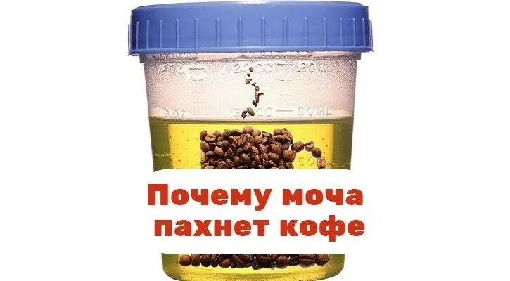Моча пахнет гречкой. Вонючая моча. моча пахнет кофе. почему после кофе моча пахнет. чем пахнет моча.