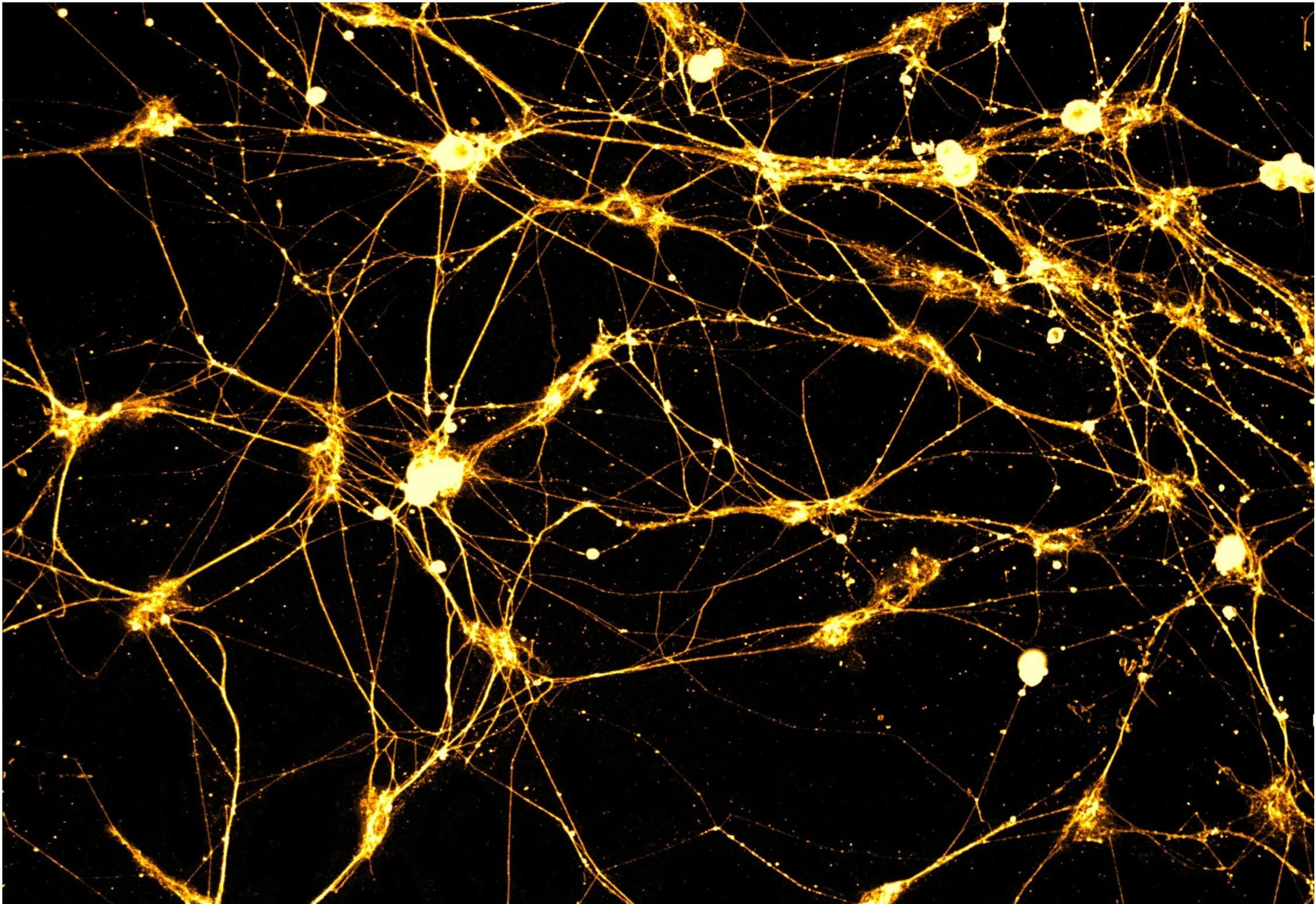 Бинг нейросеть картинок. Нейросеть Нейроны. Нейрон в нейронной сети. Золотые Нейроны. Нейронные связи в мозге.
