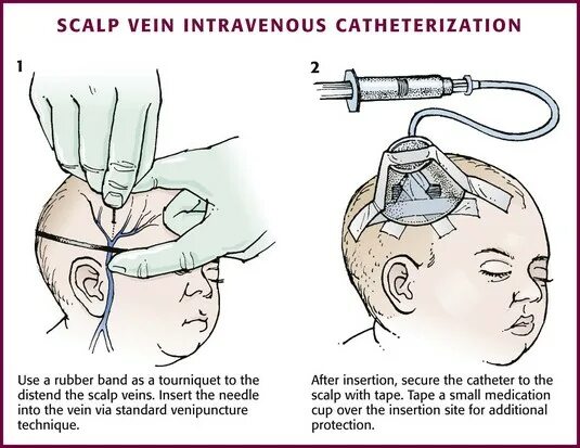 Scalp Cotril. Scalp Normalizing. Scalp Routine. Scalp перевод