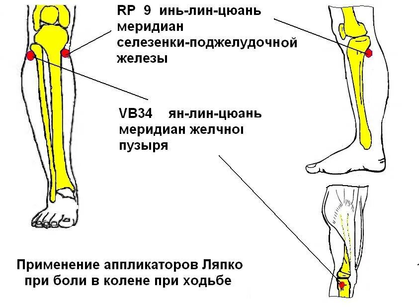 Болит под коленкой. Боли в ноге ниже колена сбоку с внутренней стороны. Боль в кости колена спереди ноги. Болит сустав сбоку коленки. Точка vb 34 Ян-Лин-цюань.