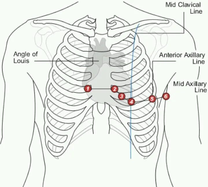 heart anatomy correlation Emergency medicine, Ekg, Ekg interpretation