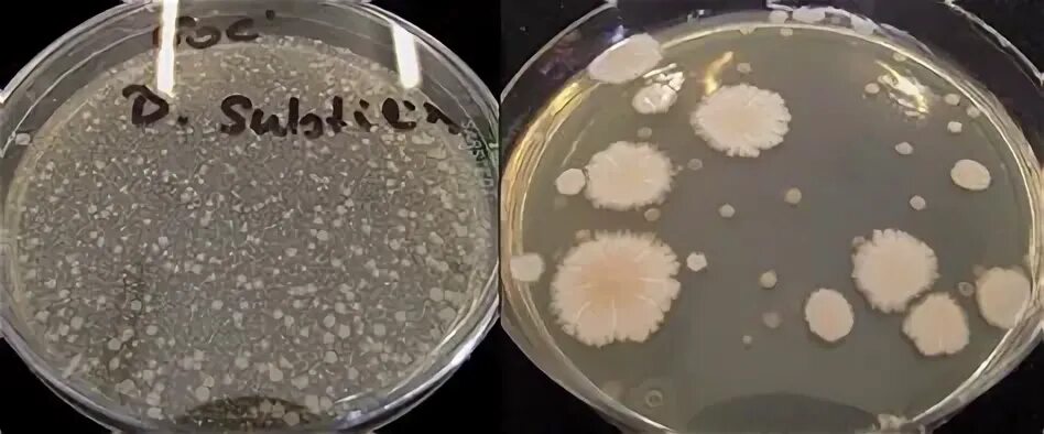 Bacillus subtilis на Петри. Bacillus subtilis колония.Сенная палочка.. Bacillus subtilis на чашке Петри. Колонии бактерий в чашке Петри. Rothia mucilaginosa