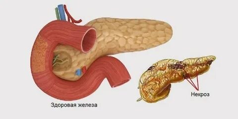 Причины нарушения поджелудочной железы