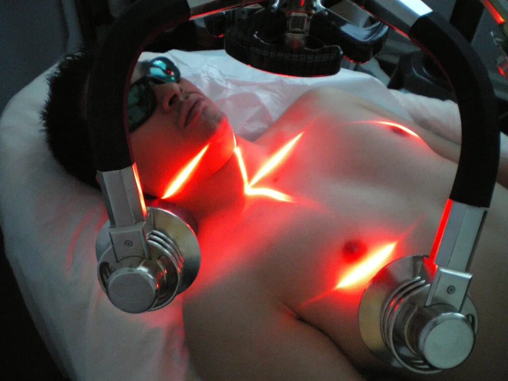 Лазер. Медицинский лазер. Лазерные технологии в медицине.