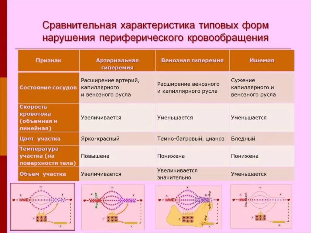 Формы нарушения кровообращения. Симптомы расстройств периферического кровообращения таблица. Формы нарушения периферического кровообращения. Типовые формы нарушений периферического кровообращения. Таблица характеристика нарушений периферического кровообращения.