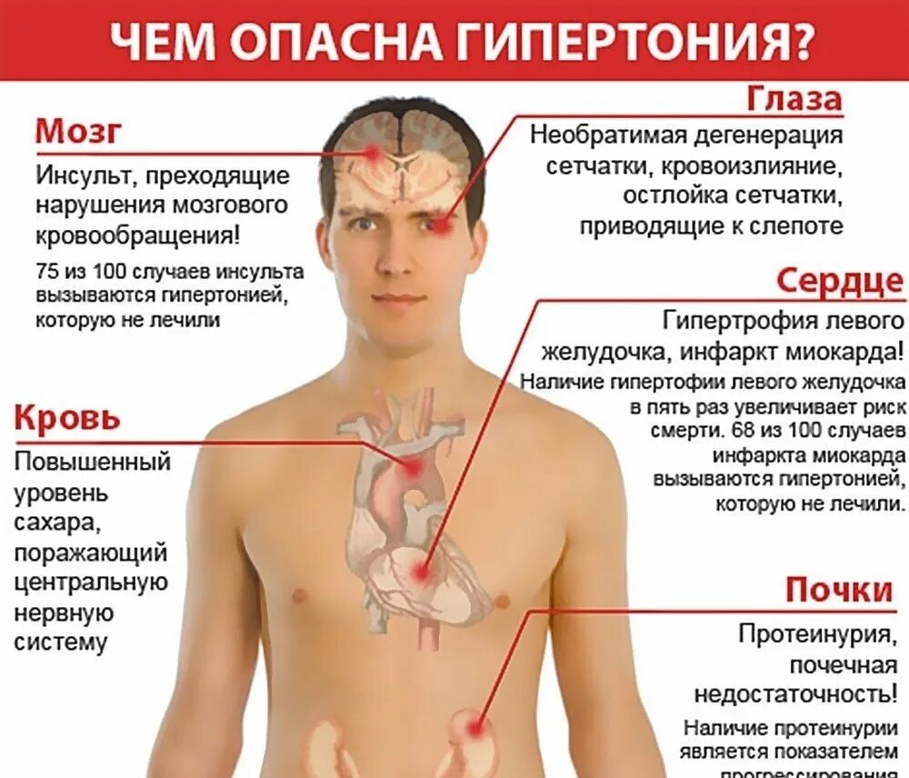 Можно курить после инсульта. Гипертония симптомы. Артериальная гипертензия симптомы. Чем опасно повышение артериального давления. Гипертоническая болезнь симптомы.