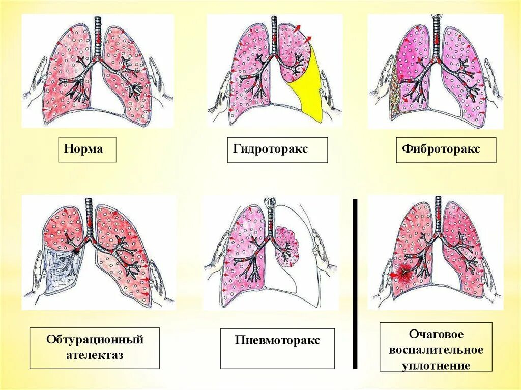 Какие легкие в норме