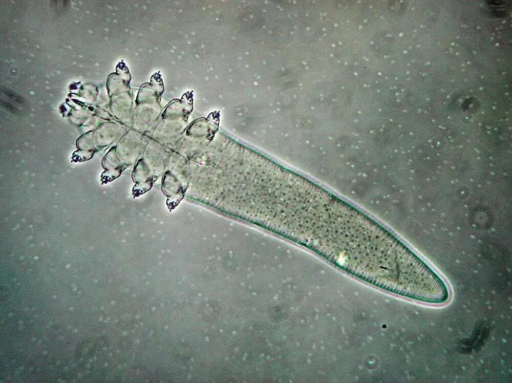 Железница угревая микроскоп. Клещ Demodex folliculorum микроскоп
