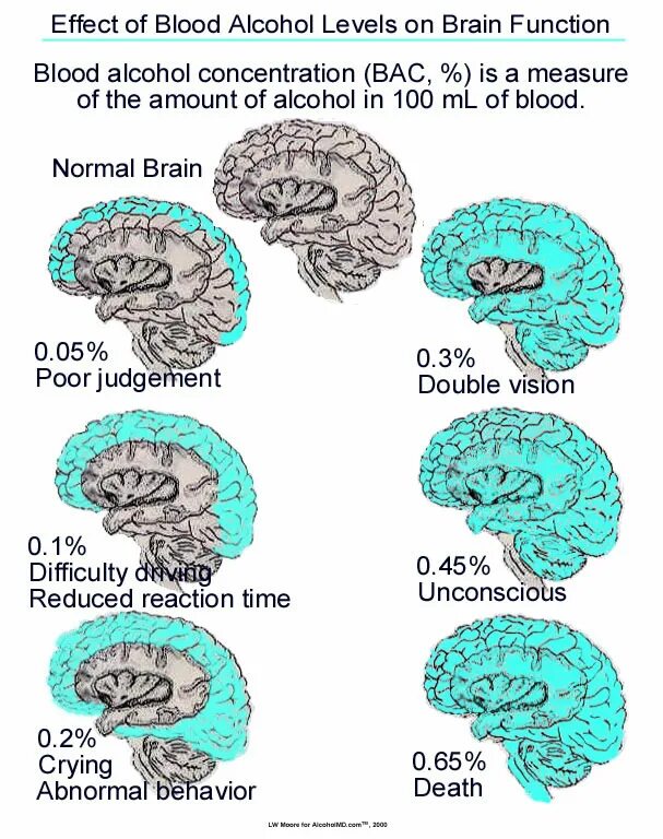 Здоровый мозг и мозг алкоголика. Мозг алкоголика картинки. Brain effect
