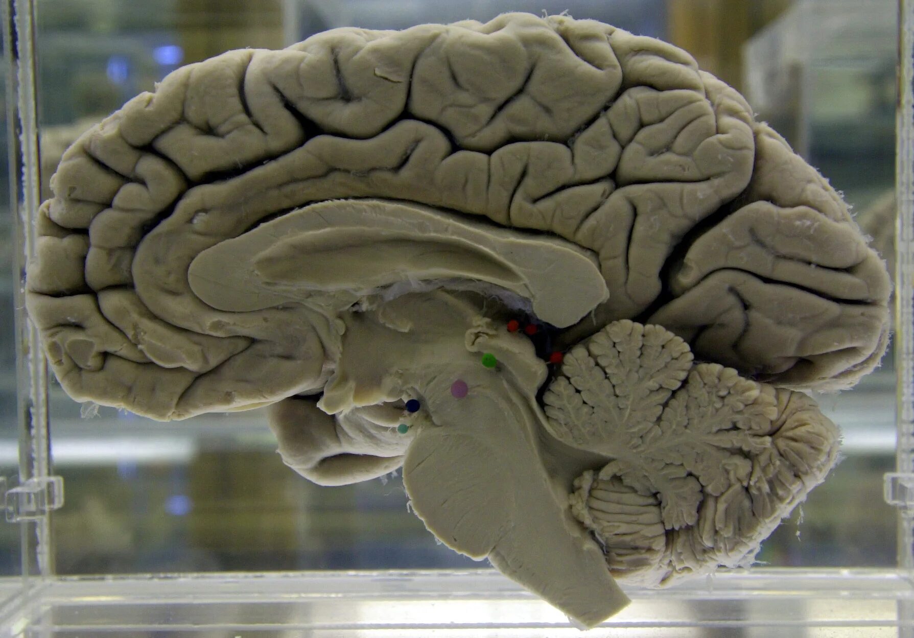 Brain 229. Головной мозг настоящий. Настоящий человеческий мозг.