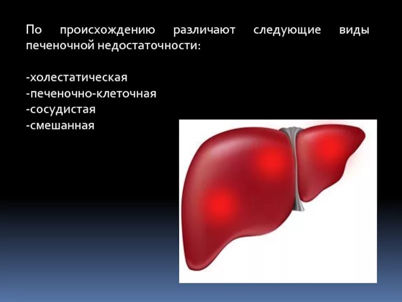 Печеночная недостаточность. Хроническая печеночная недостаточность. Сосудистая печеночная недостаточность. Холестатическая печеночная недостаточность.