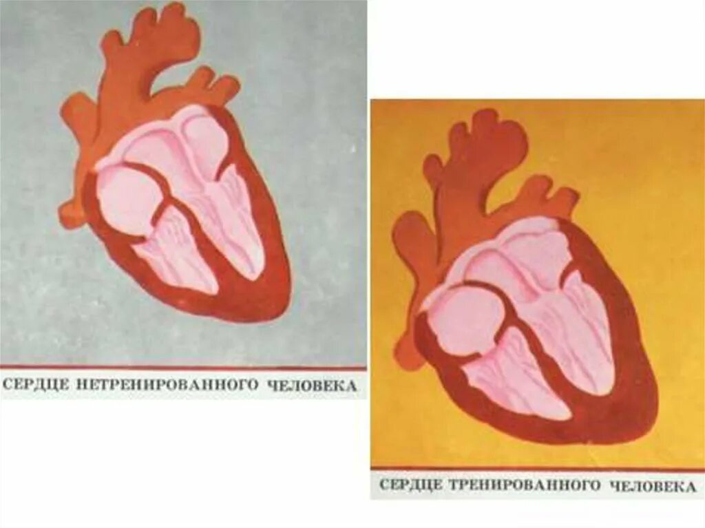 Тренированность сердца. Сердце нетренированного человека. Сердце тренированного и нетренированного человека. Сердце человека и спортсмена. Сердце здорового человека и спортсмена.