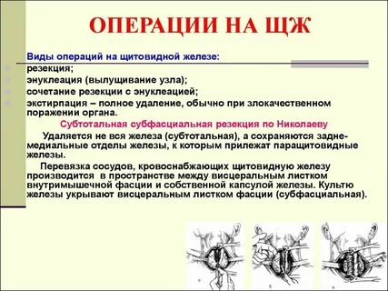 Удаление перешейка щитовидной железы