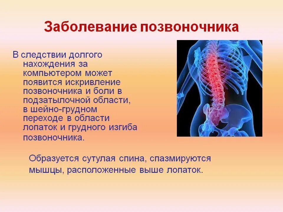 Болезни позвоночника. Заболевания спины и позвоночника. Причины заболевания позвоночника. Хронические заболевания позвоночника.