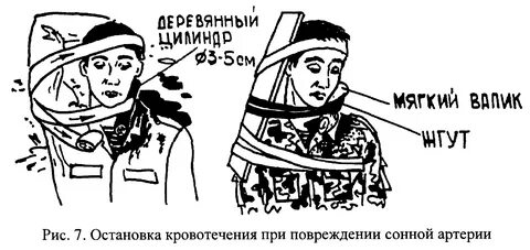 Жгут на шею