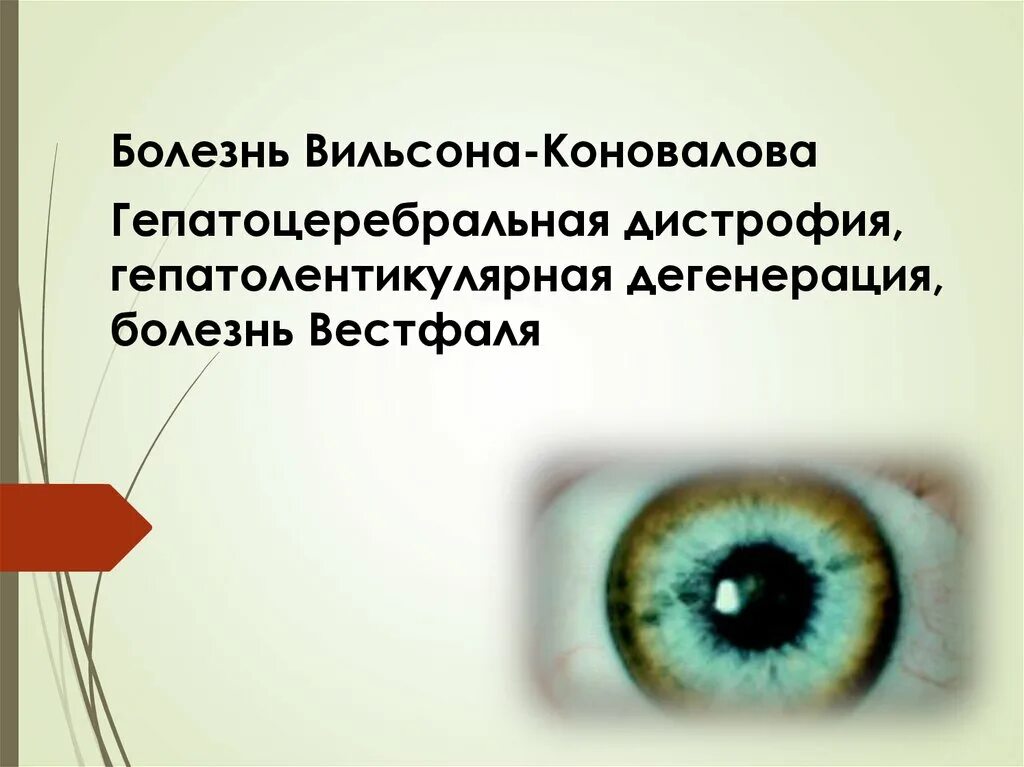 Синдром вильсона коновалова что это такое простыми. Кольца Кайзера Флейшера при Вильсона Коновалова. Гепато-церебральная дистрофия Вильсона-Коновалова. Кольцо Флейшера при болезни Вильсона-Коновалова. Гепатоцеребральная дистрофия (болезнь Вильсона).